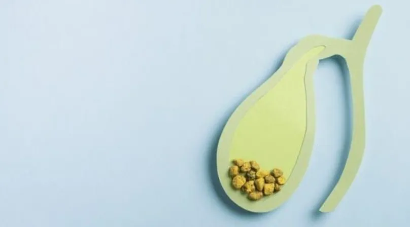 Gallstones & Gallbladder Disease